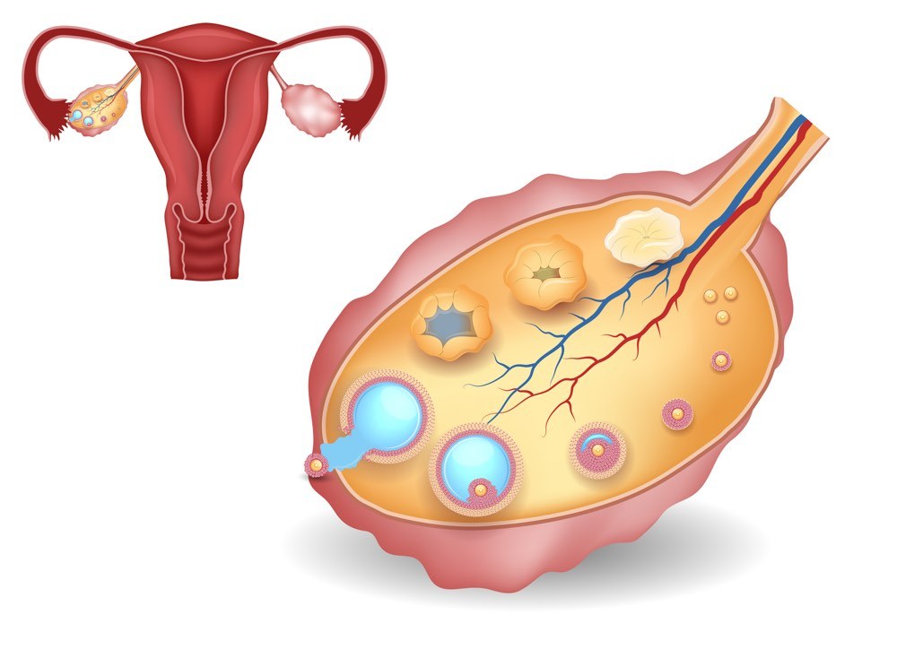 ovulation induction